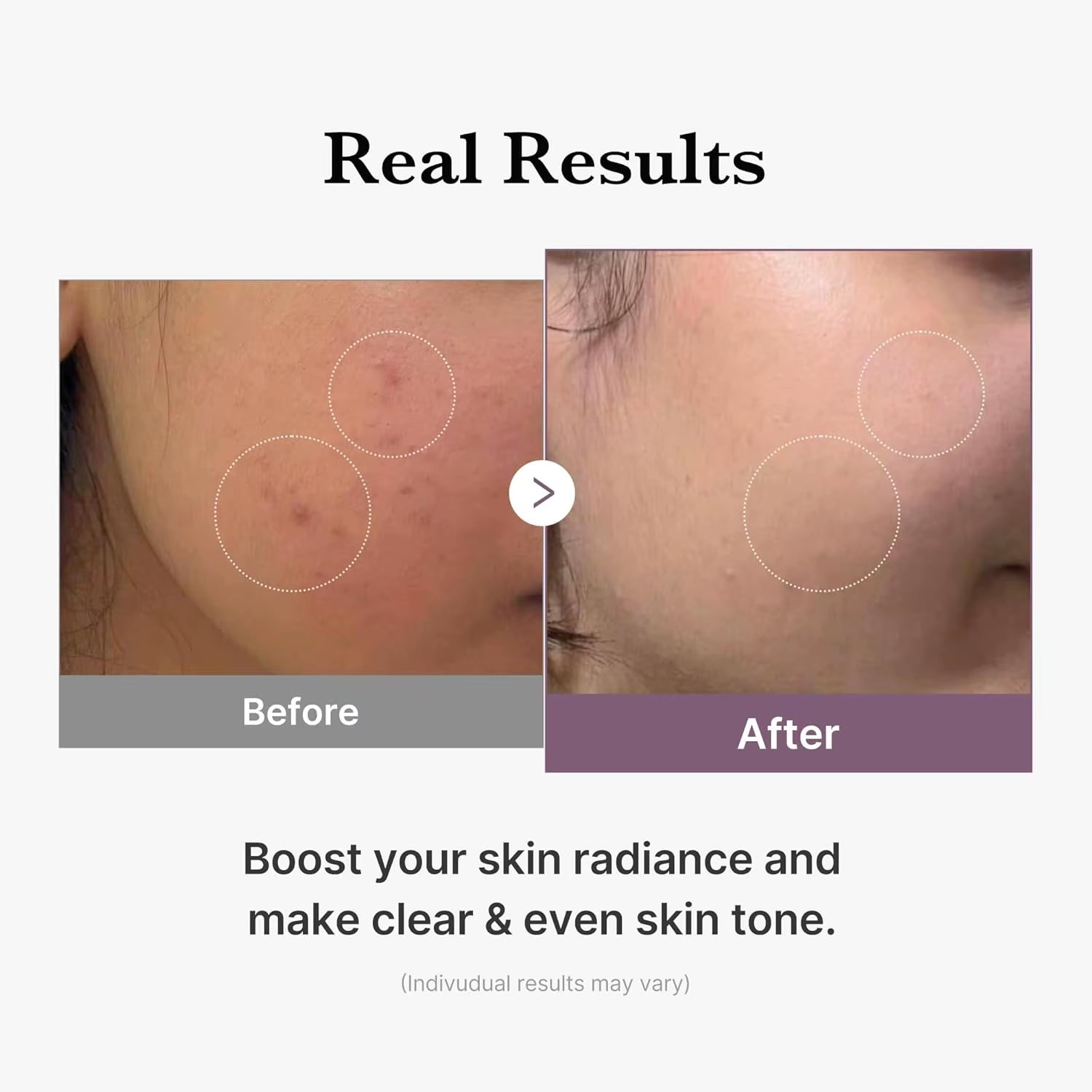 Medicube Age-R Glutathione Glow Milky Toner Low-Irritation Double for Glass Glow Even Skin Tone, Radiance Korean Skincare