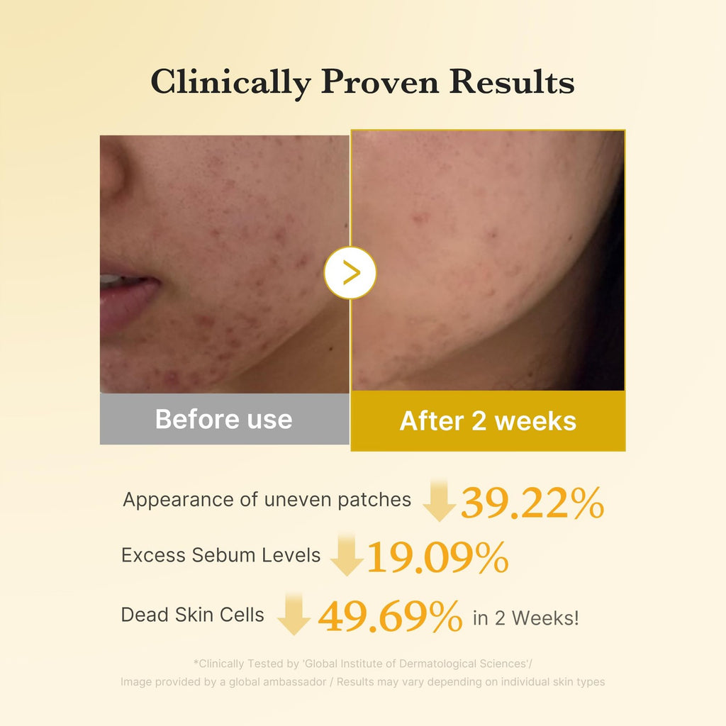 Medicube Kojic Acid Turmeric Clarifying Toner Pads for Troubled Skin