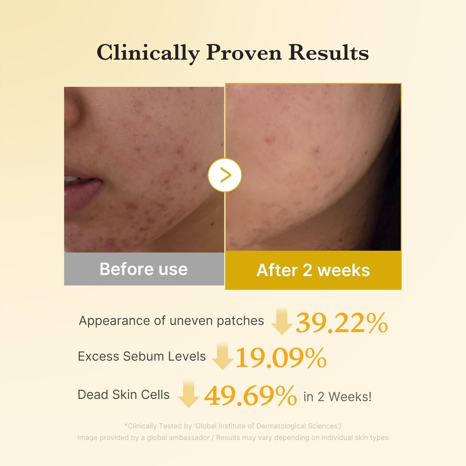 Medicube Kojic Acid Turmeric Clarifying Toner Pads for Troubled Skin